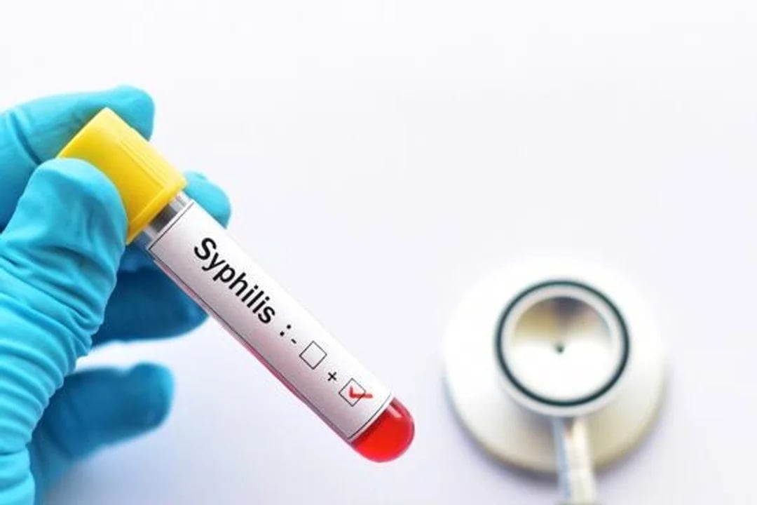 sifilis, campaña prevencion