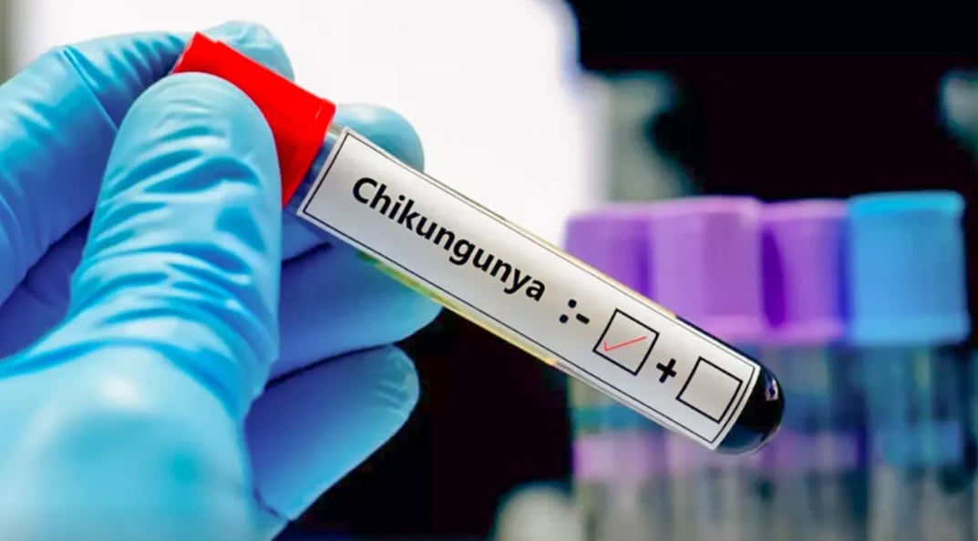 Solo 19 casos más se confirmaron en tres días.