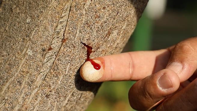 Médicos de Perú utilizan la planta amazónica Sangre de Drago en el tratamiento de VIH.