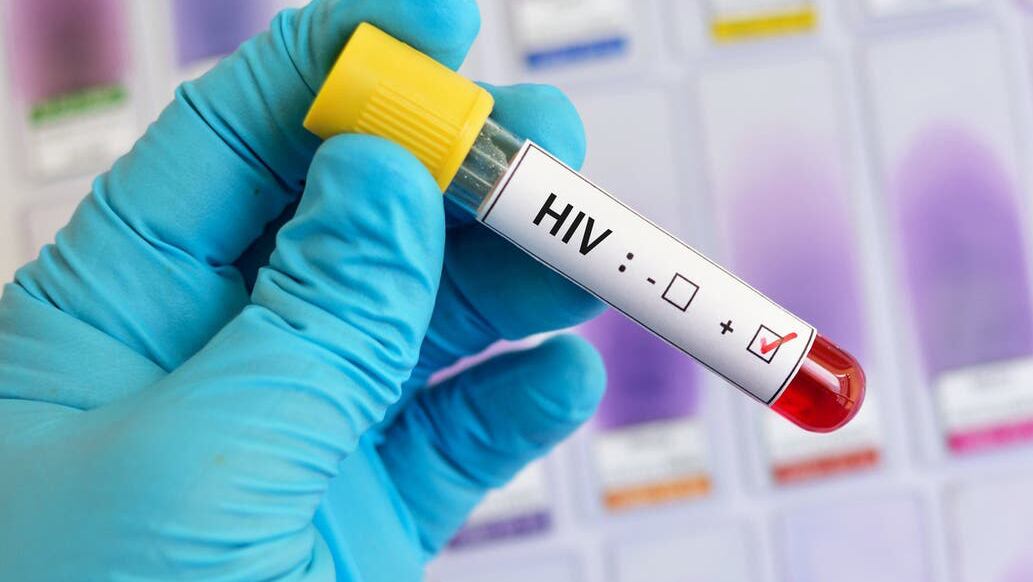 Hay 86.338 pacientes con VIH que se encuentran en tratamiento antirretroviral.