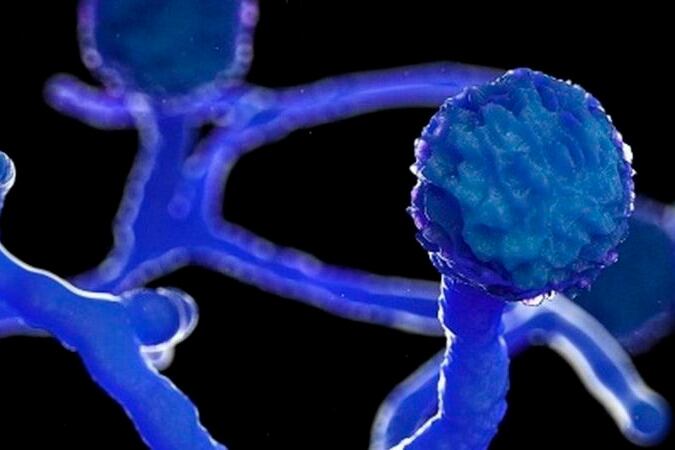 El "hongo negro" fue detectado en un enfermo de covid-19 en Uruguay.