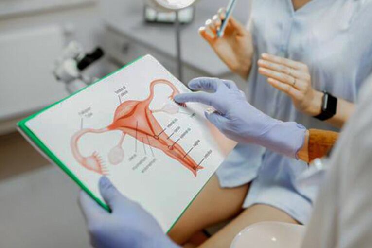 Qué es una histerectomía, la cirugía que le realizarán a Cristina Kirchner.