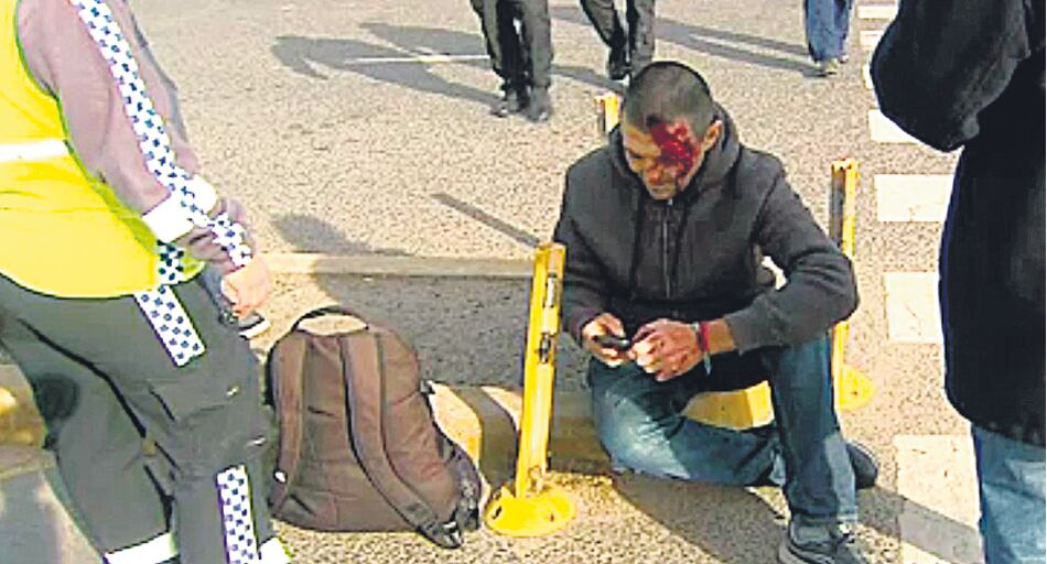 Delgado sufrió golpes y cortes en su cabeza por el accidente.