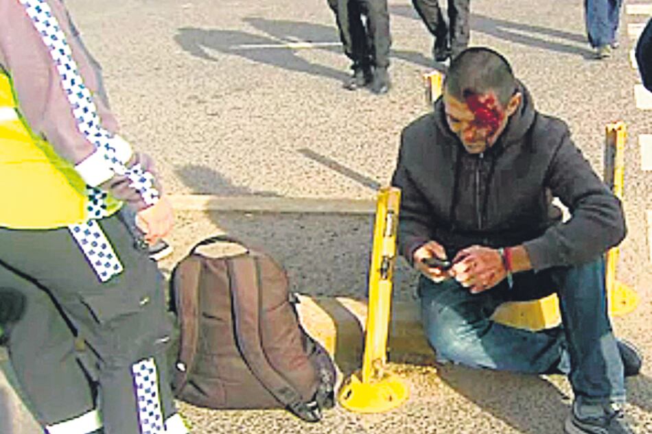 Delgado sufrió golpes y cortes en su cabeza por el accidente.