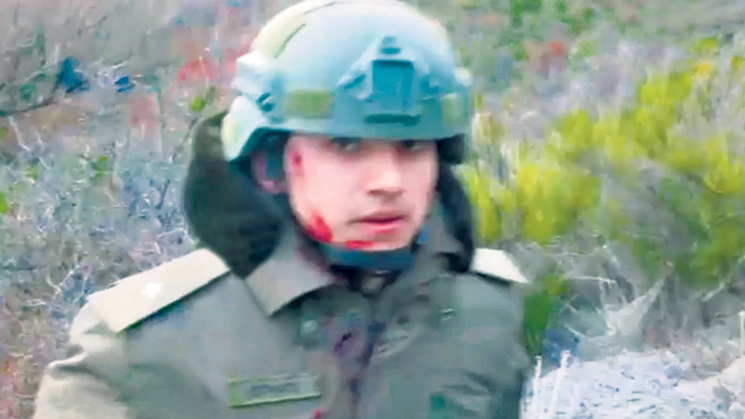 Emmanuel Echazú, el día de la represión, con la herida en la cara que para los querellantes podría haber recibido al enfrentarse con Santiago Maldonado.