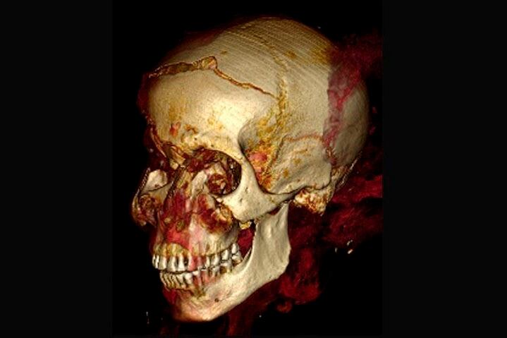 El estudio determinó que Seqenenre tenía alrededor 40 años cuando murió.