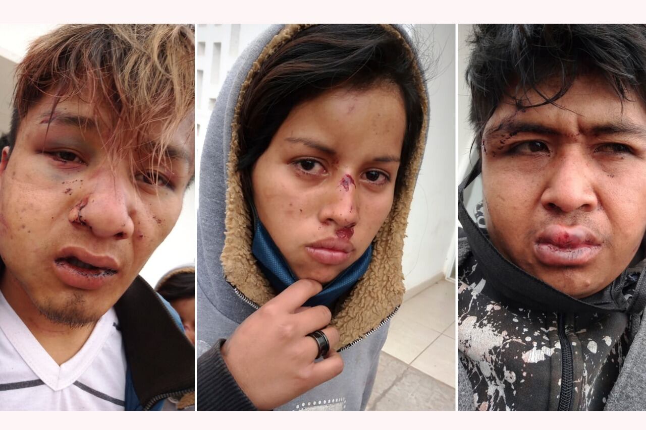 Los jóvenes de la familia Fernández-Saravia, tras el ataque.