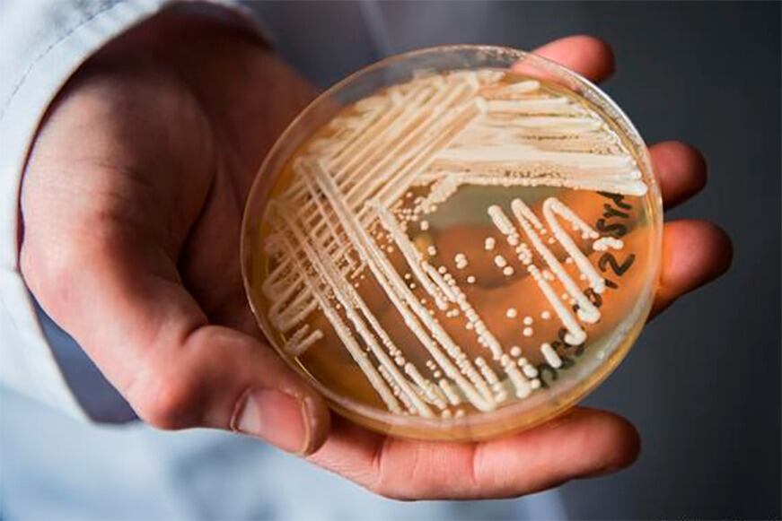 Fiebre y escalofríos son los síntomas que causa el hongo. 