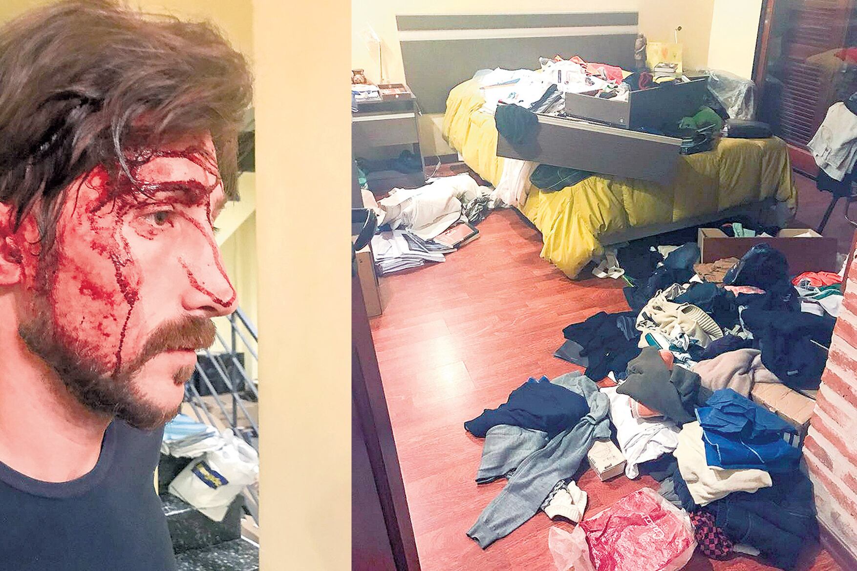 Hernán Letcher fue golpeado brutalmente por sus agresores. Así quedó la casa del concejal de Unidad Ciudadana tras el ataque.