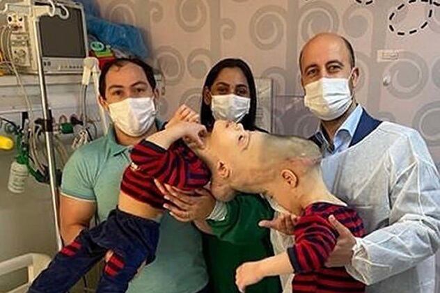 Arthur y Bernardo Lima nacieron en 2018 como gemelos craneópagos, una condición extremadamente rara por la que los hermanos están fusionados en el cráneo. Foto: Instituto Estatal del cerebro Paulo Niemeyer
