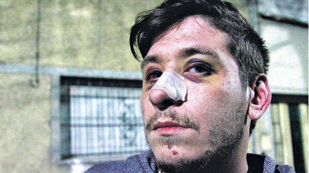 Alan Juárez quedó inconsciente por las patadas en la cabeza que recibió de los policías.