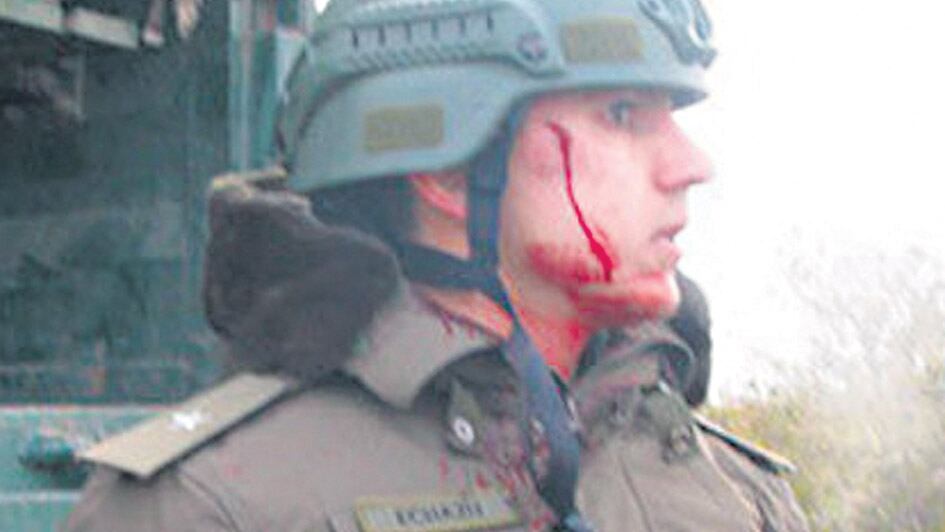 Echazú, ensangrentado. “No fue nada, no sé”, dijo en el momento.