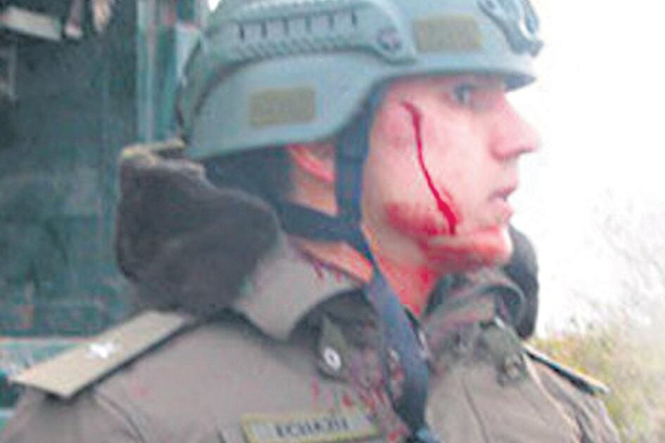 Echazú, ensangrentado. “No fue nada, no sé”, dijo en el momento.