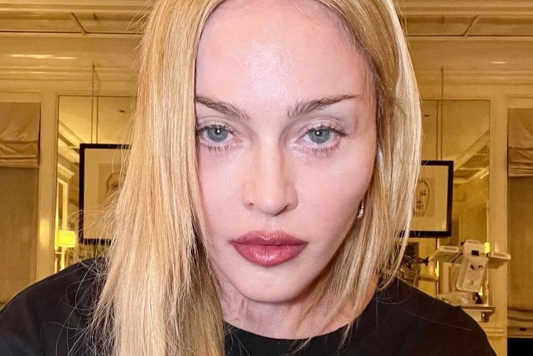 Madonna tenía programadas 35 fechas para el tour mundial "Celebration" por Estados Unidos y Europa. (Foto: Instagram @madonna)