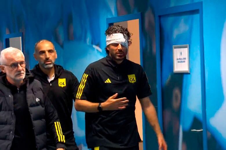 Grosso luego de ser atendido y recibir doce puntos en su rostro