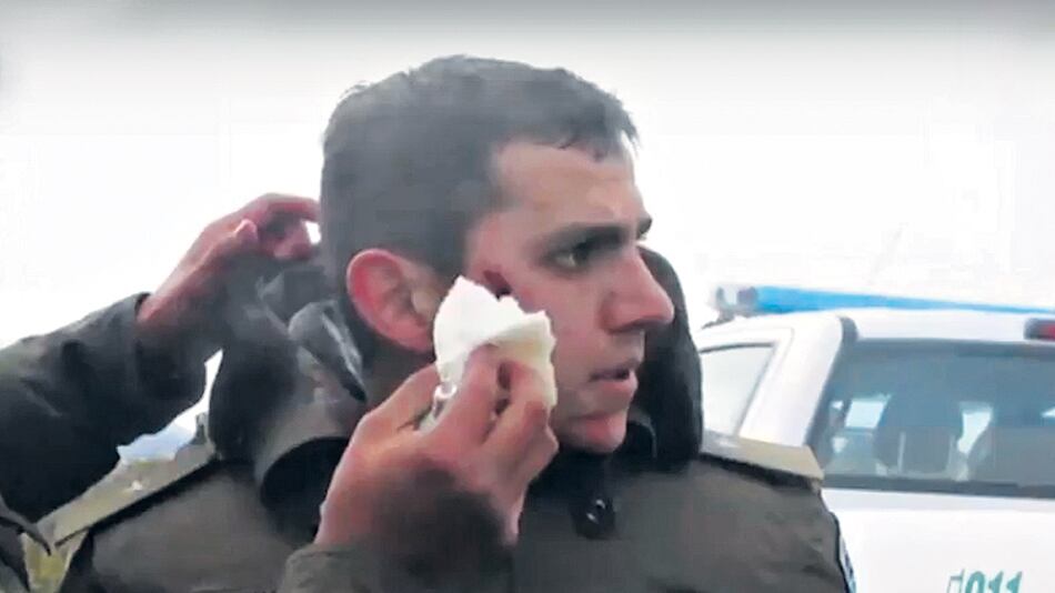 Emmanuel Echazú dijo que lo hirieron cerca de la ruta.