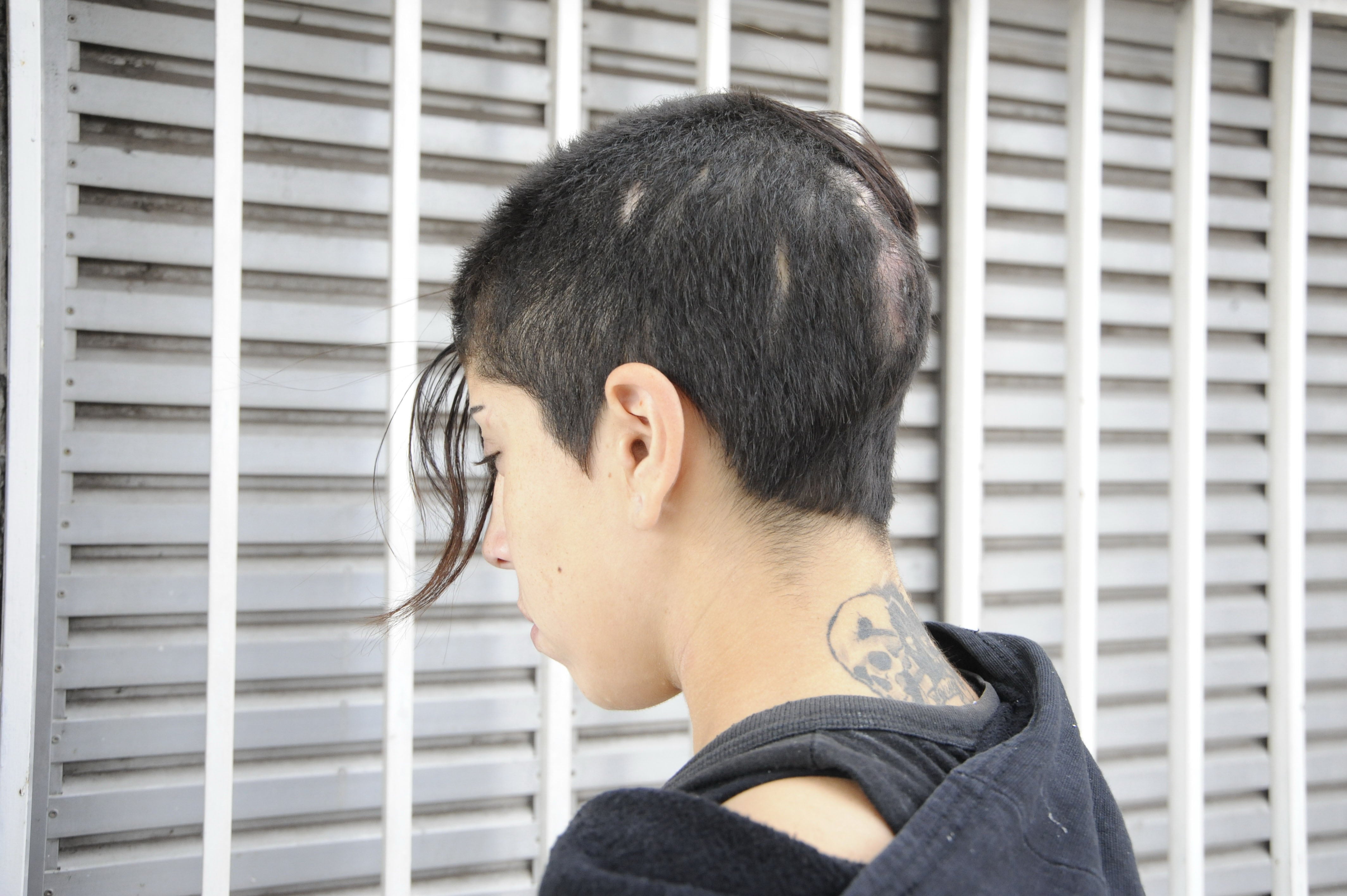 Elina tiene 27 años y es punk. Muestra las heridas que le quedaron en la cabeza por los golpes.