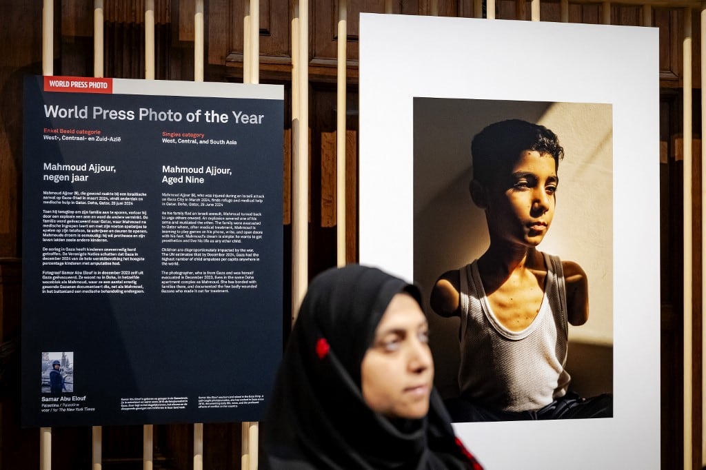 La imagen de un niño palestino amputado ganó el premio World Press Photo