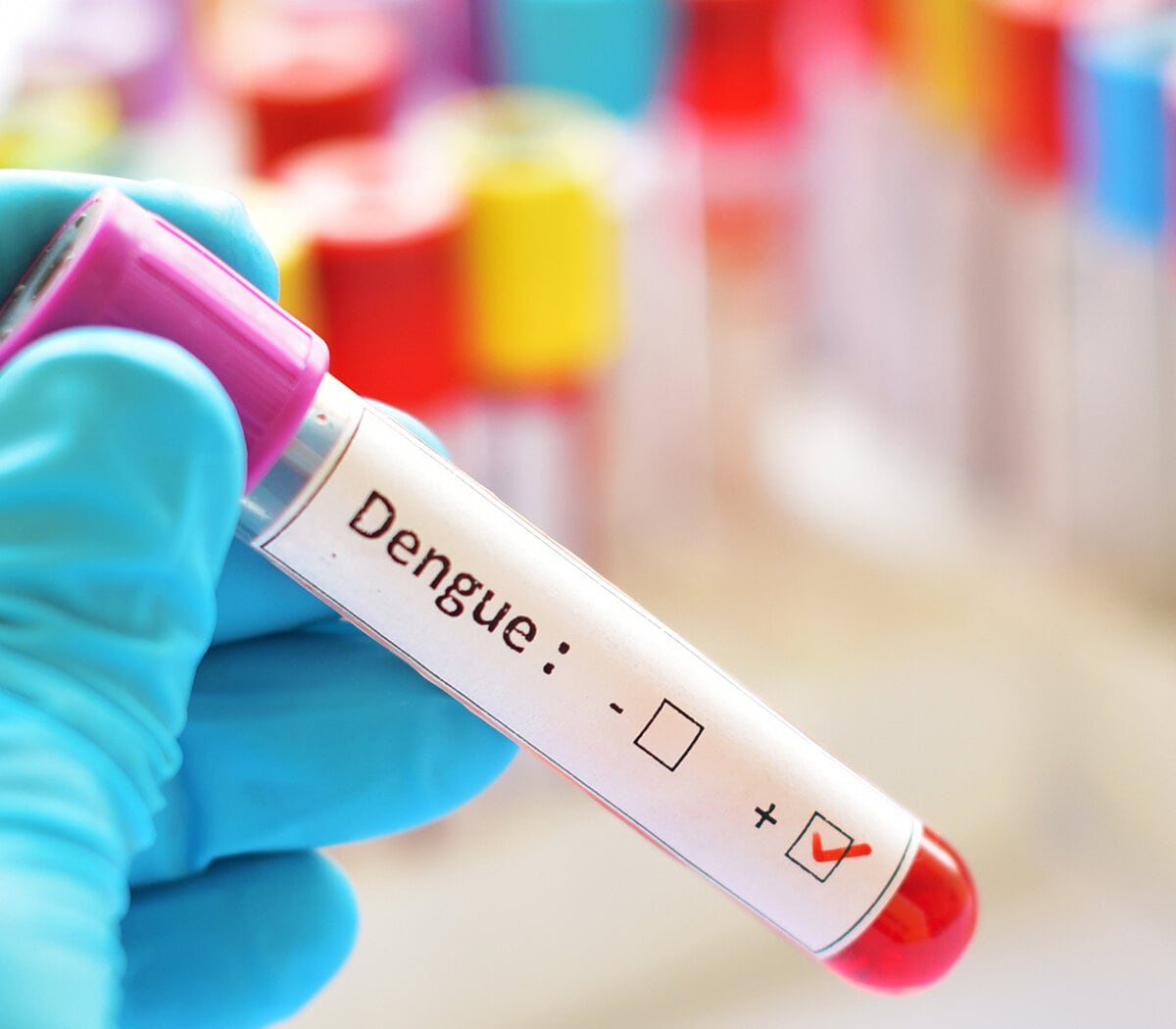 Cuba está desarrollando una vacuna que sirva para los cuatro serotipos del virus del dengue.