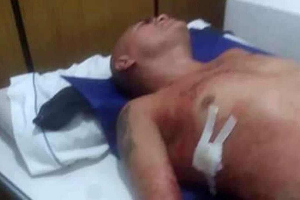 El boxeador Rodrigo "La Hiena" Barrios recibió heridas leves al ser apuñalado esta madrugada en Córdoba.