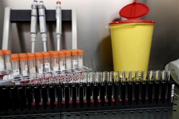 El costo total será de algo menos de 20 dólares en el mundo.