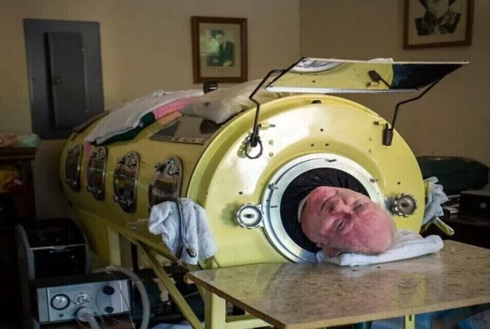 Murió Paul Alexander, el hombre que vivió más de 70 años en un pulmón de acero. Imagen: GoFundMe