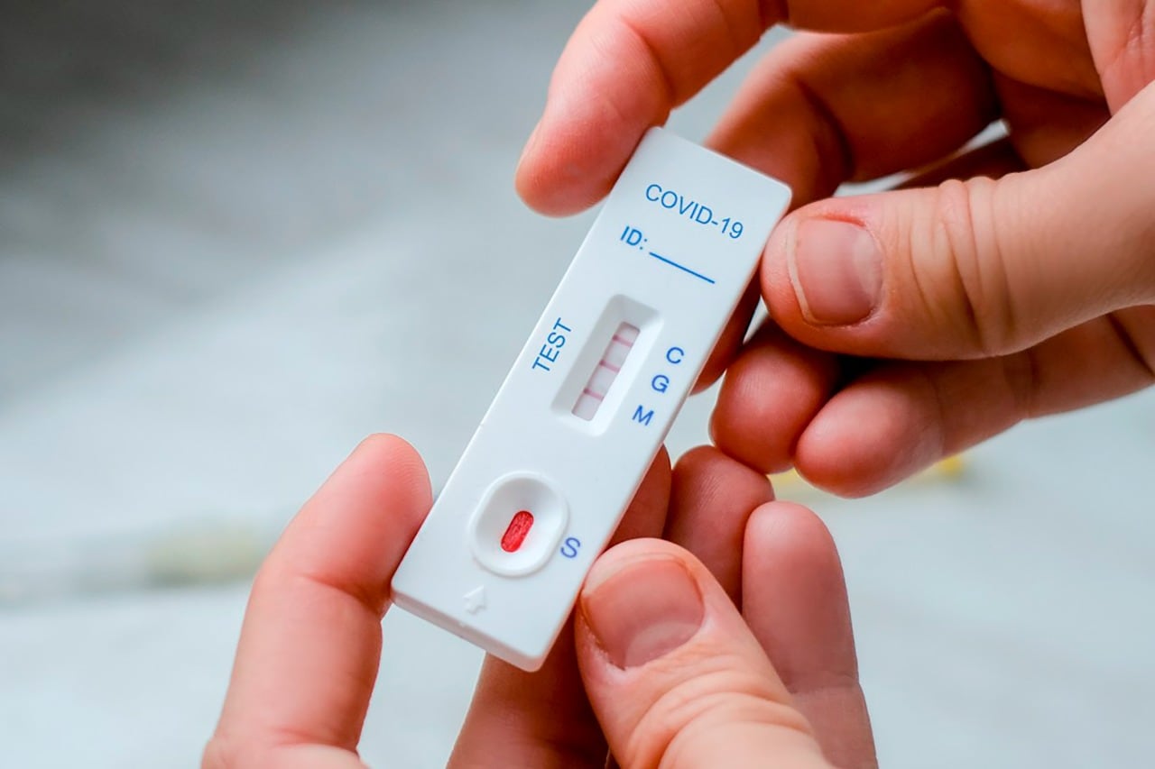 Los test aprobados son de los laboratorios Abbott, Roche, Vyam Group y Wiener.