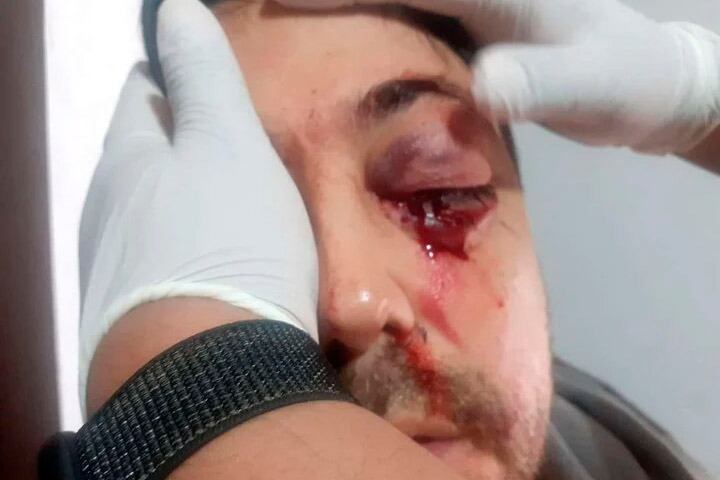 Así quedó el hombre agredido en la puerta de un colegio.