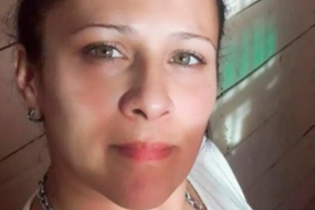 Erica Olguín se encuentra internada en terapia intensiva, con el 70 por ciento de su cuerpo quemado. 