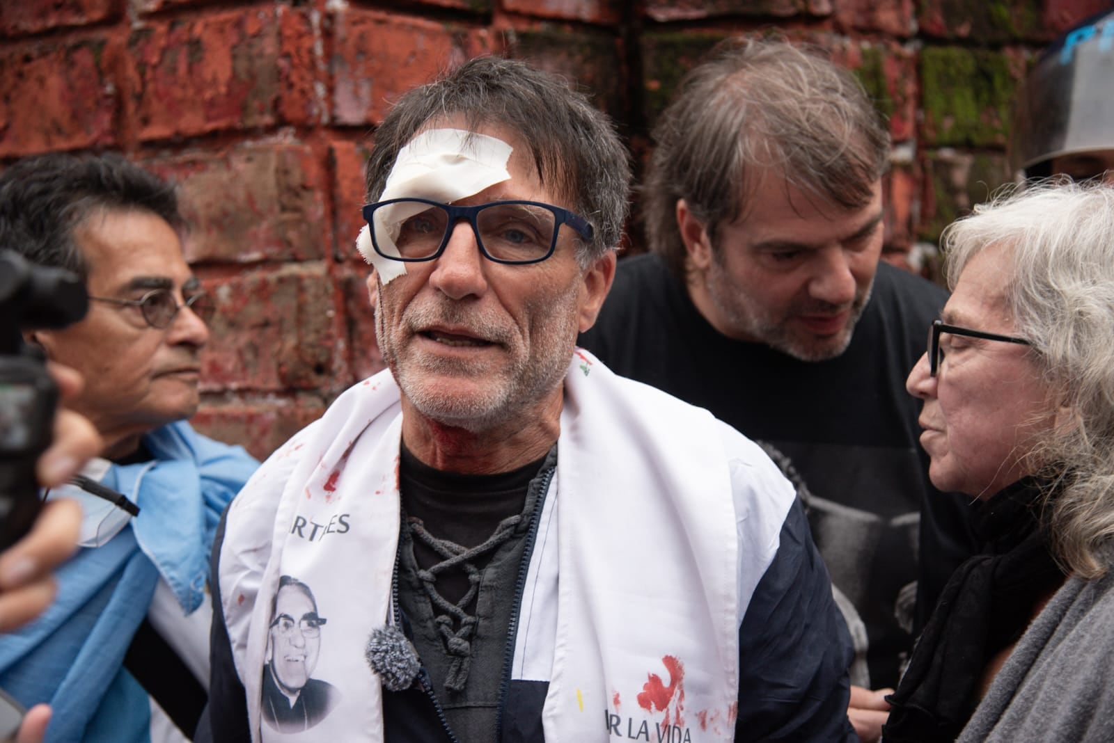 Olveira recibió un golpe en su ceja derecha.