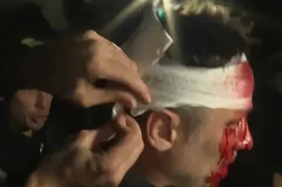 El periodista Cristian Mercatante, del canal América, resultó herido durante la cobertura