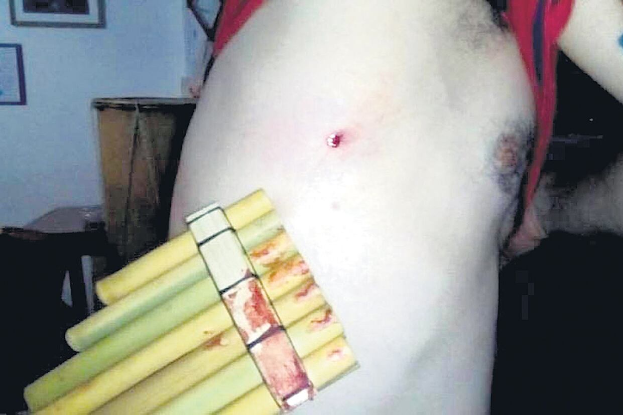 Los tiros fueron disparados con un rifle de aire comprimido.