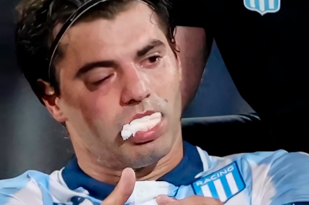 La imagen de cómo quedó Sosa es por demás elocuente