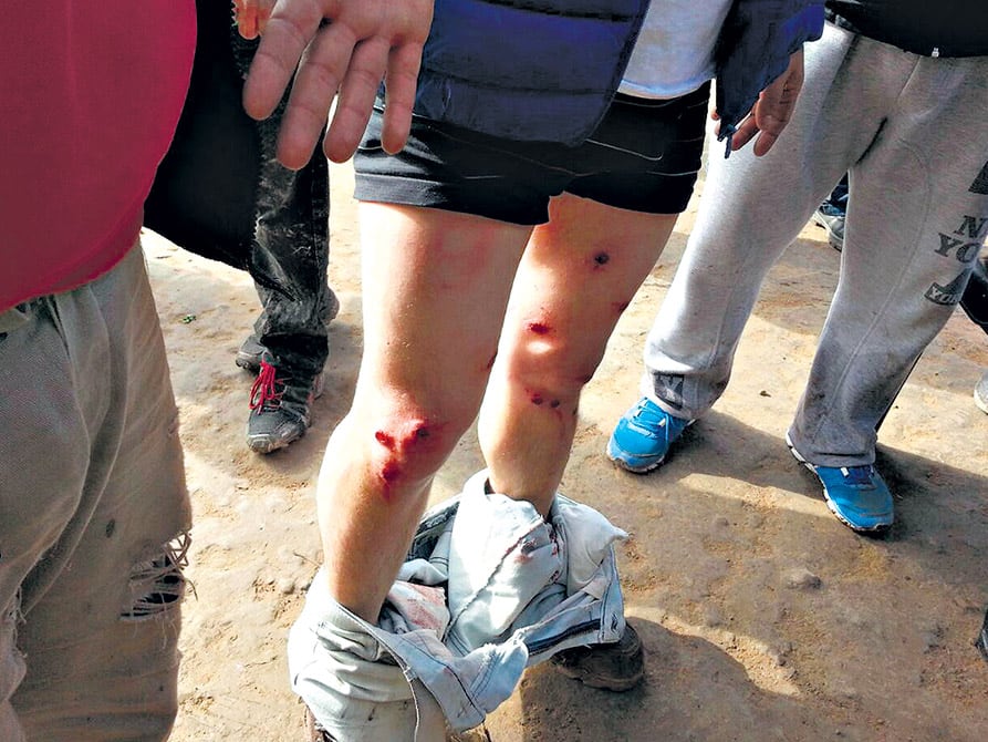 Heridas por la represión a los trabajadores del Ingenio Ledesma en Jujuy en julio del año pasado. 