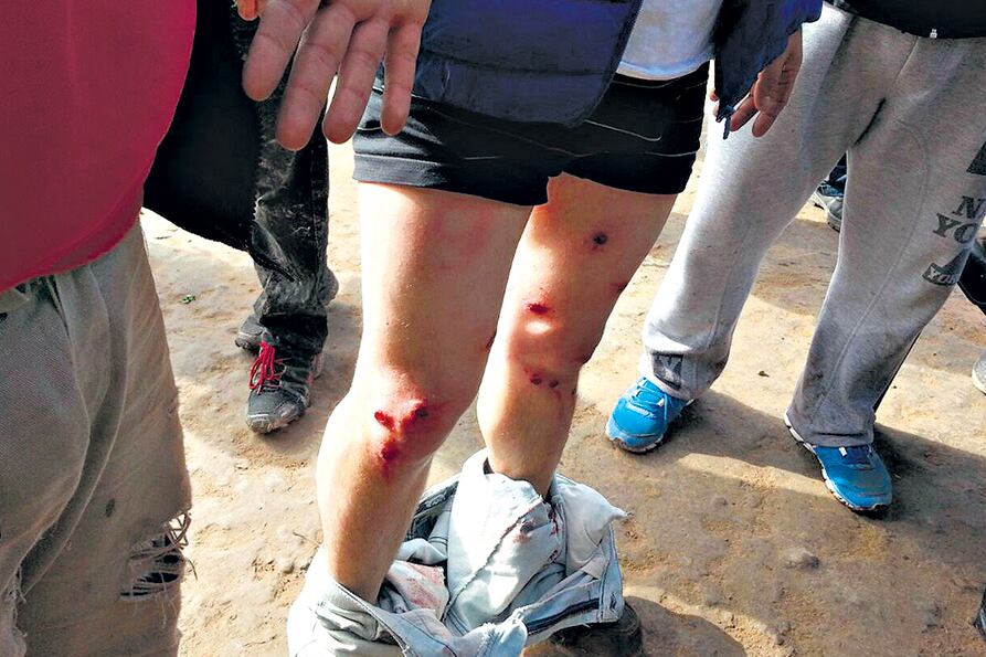 Heridas por la represión a los trabajadores del Ingenio Ledesma en Jujuy en julio del año pasado.