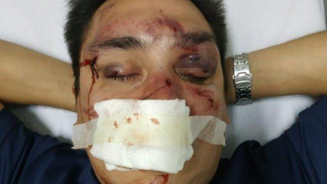 Acosta tendrá que ser operado tras la brutal golpiza recibida.