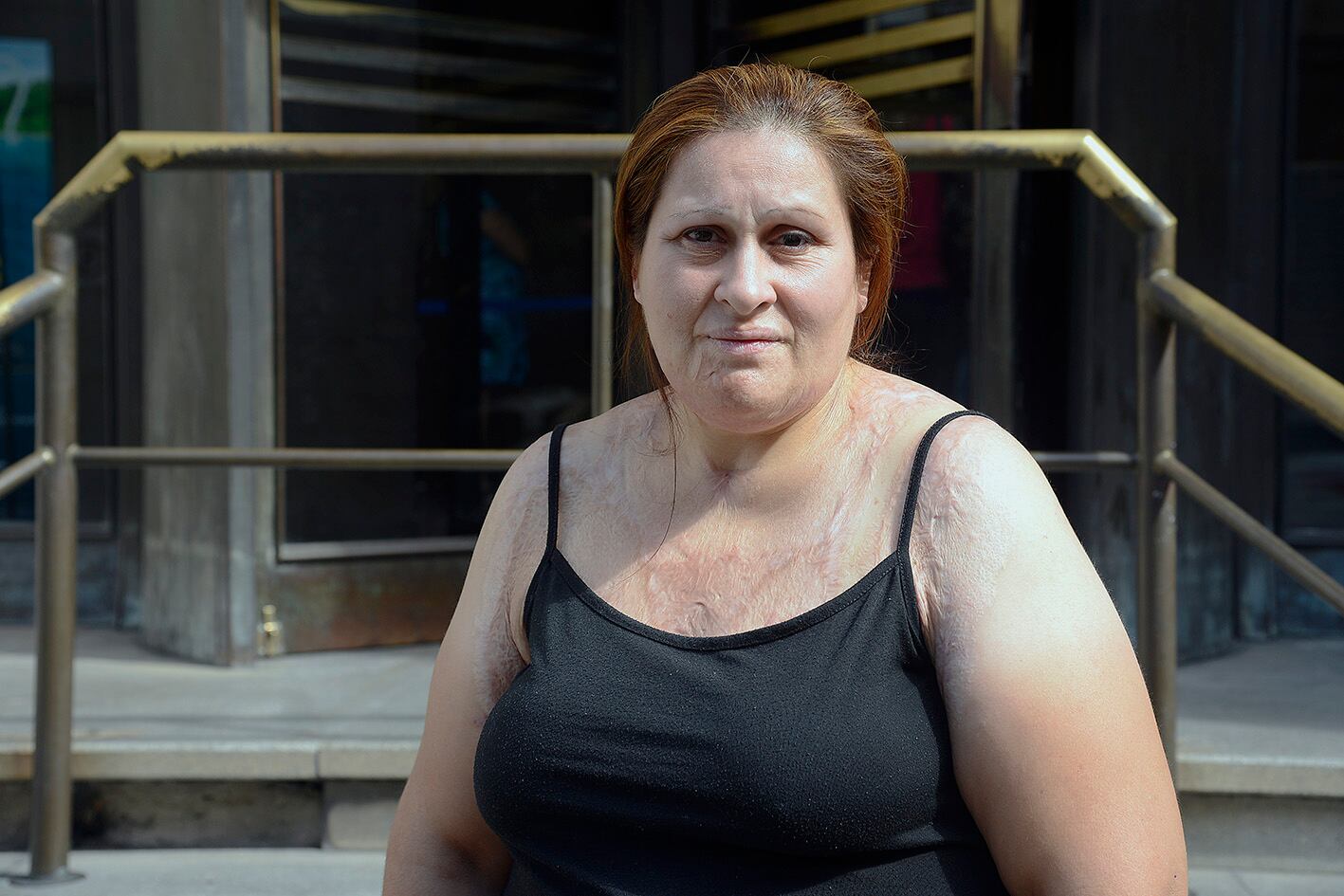 Alicia atestiguó ayer contra su ex esposo, que la quemó.