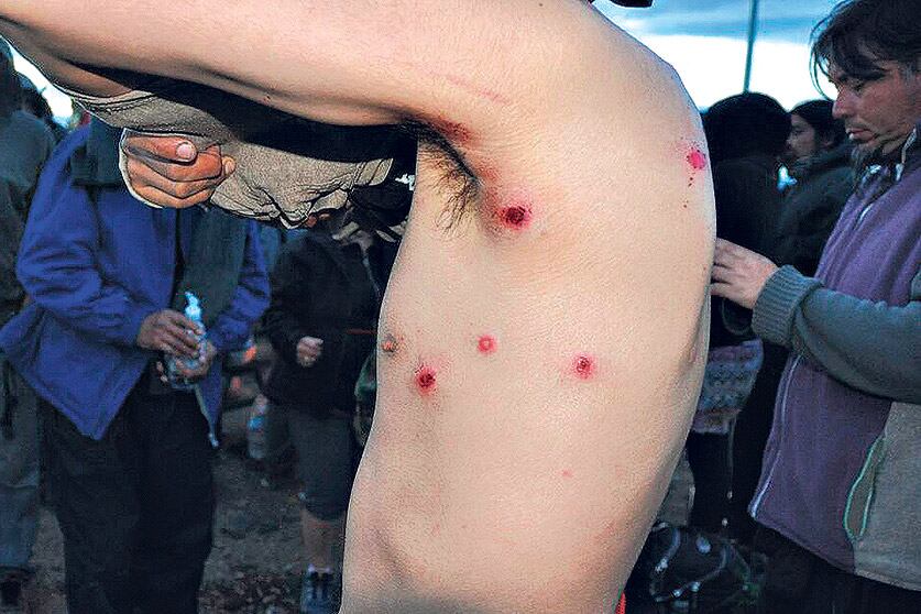 La violenta represión a los mapuches dejó varios heridos, dos de ellos de gravedad.