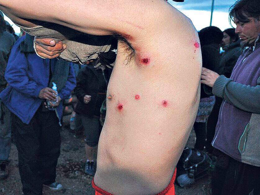 La violenta represión a los mapuches dejó varios heridos, dos de ellos de gravedad.