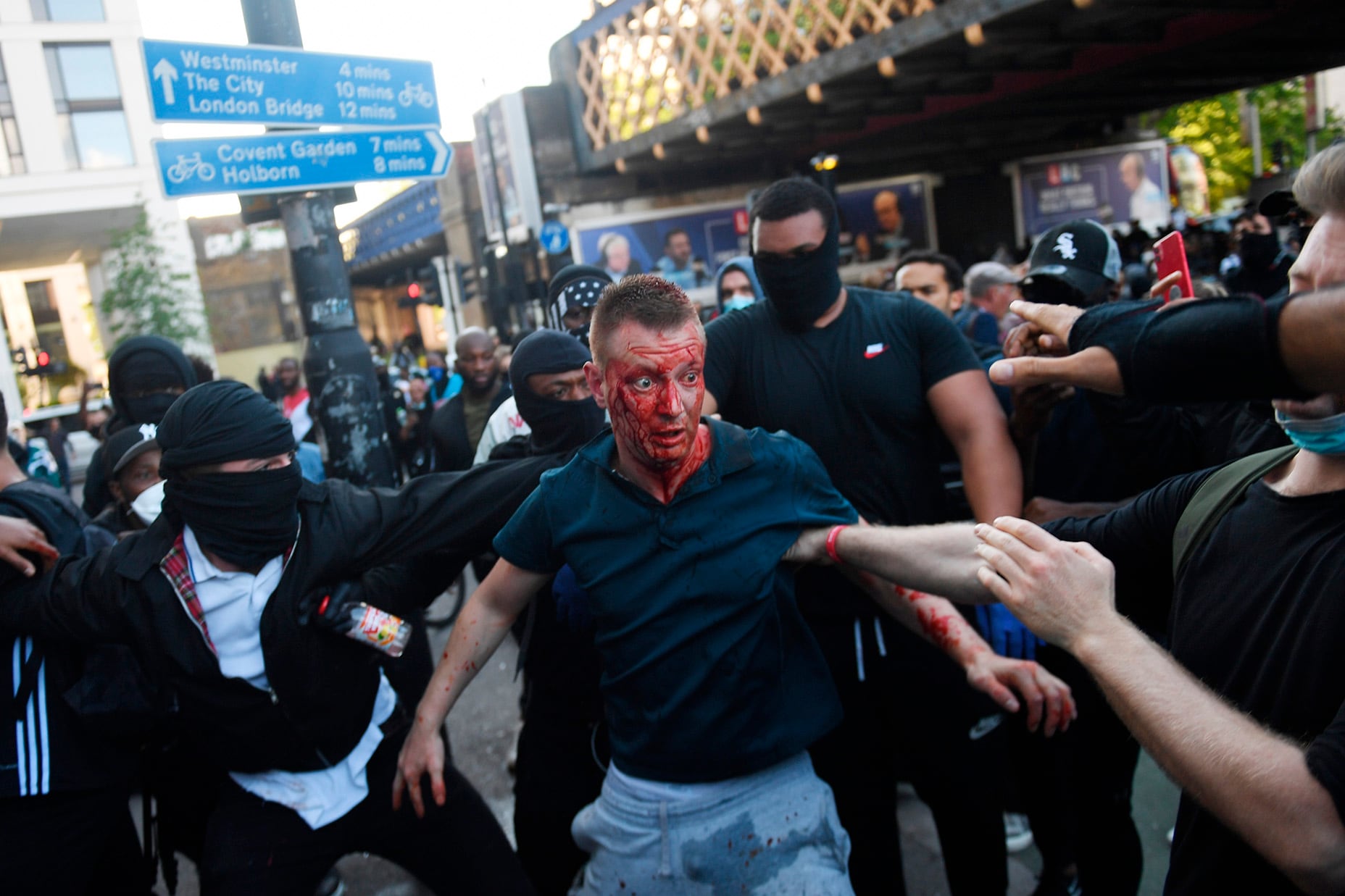 Un contramanifestante herido durante la protesta antirracista en Londres.