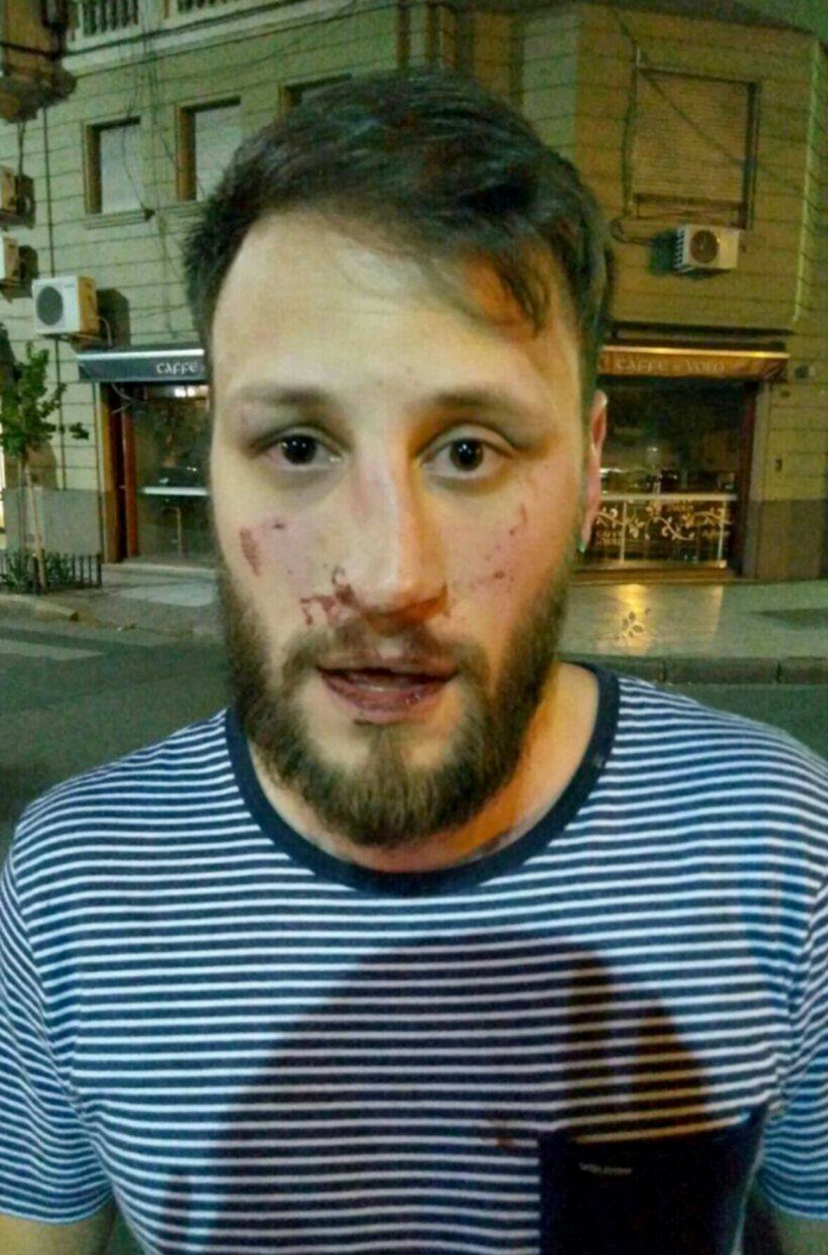 Angel Leonardi recibió golpes en la cara.