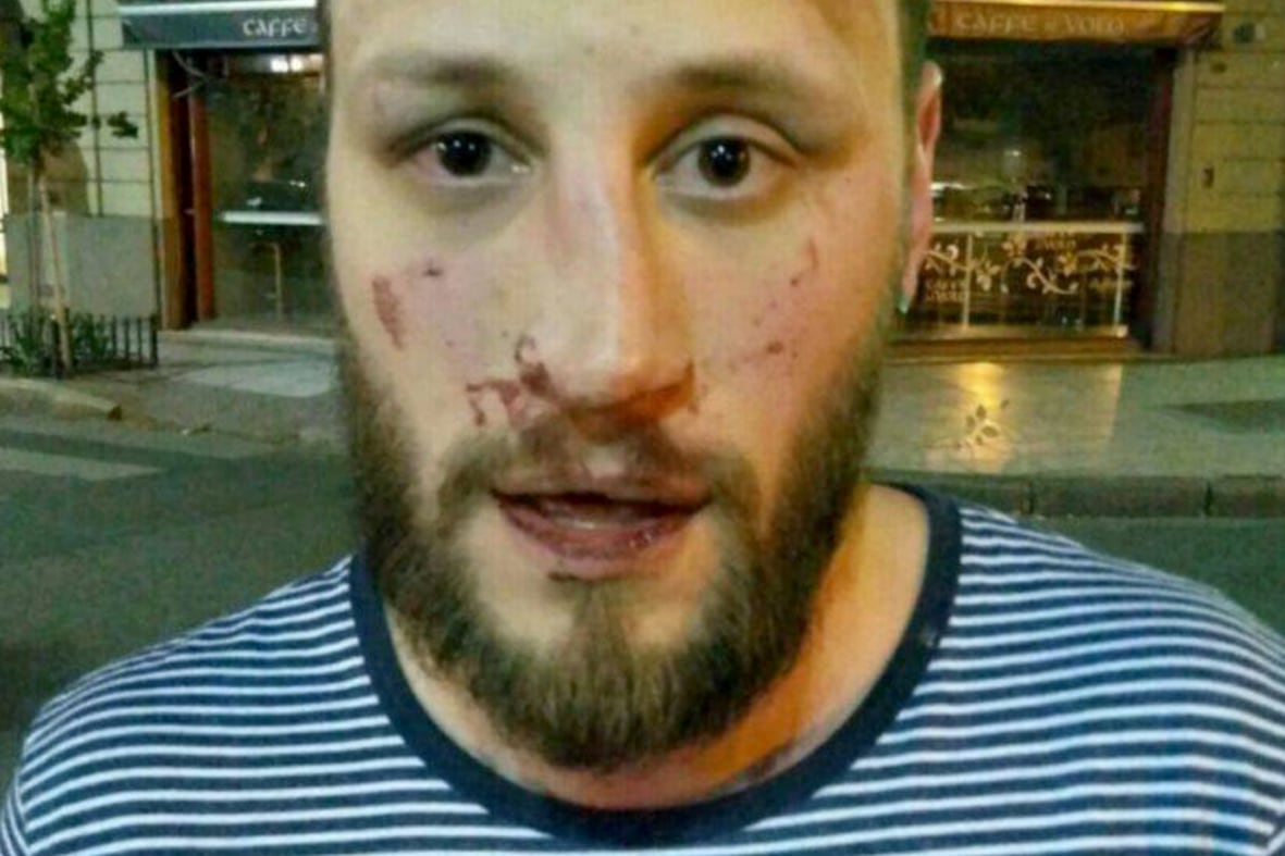 Angel Leonardi recibió golpes en la cara.