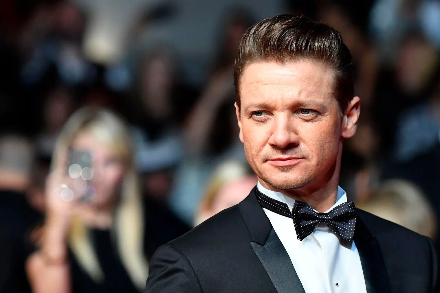 "La mitad de mi cara y todo el lado derecho de mi espalda son de metal"