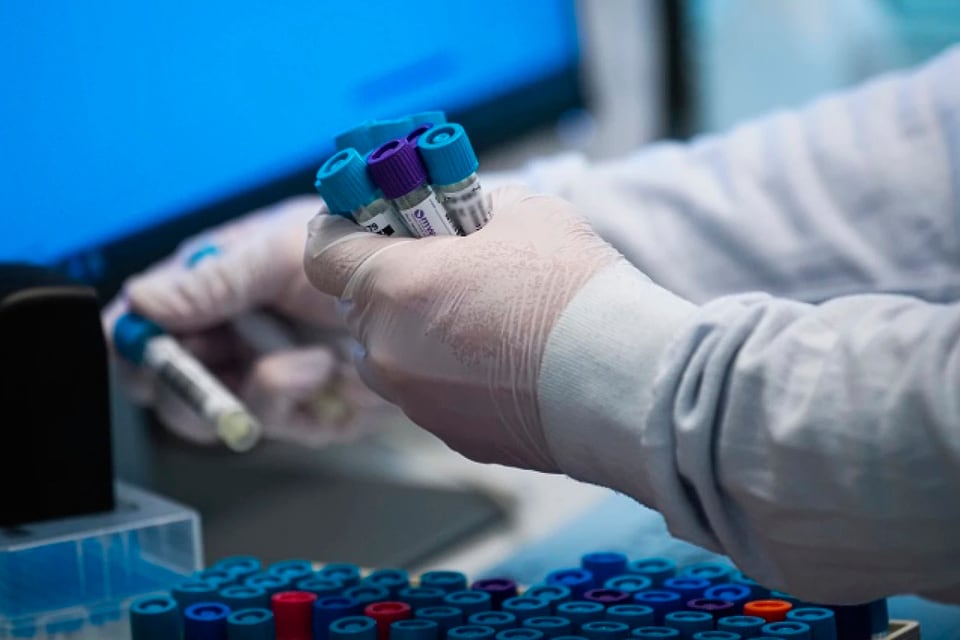 El Ministerio de Salud confirmó que se detectaron dos casos de Candida auris en el país.