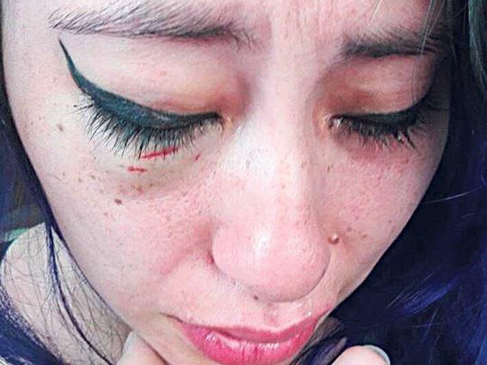 El video abre y cierra con la cara golpeada de Jenn Retamozo.