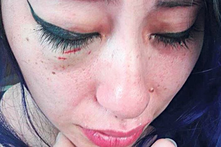 El video abre y cierra con la cara golpeada de Jenn Retamozo.