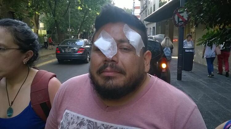 Daniel Sandoval, una de las víctimas de la represión policial el lunes pasado.