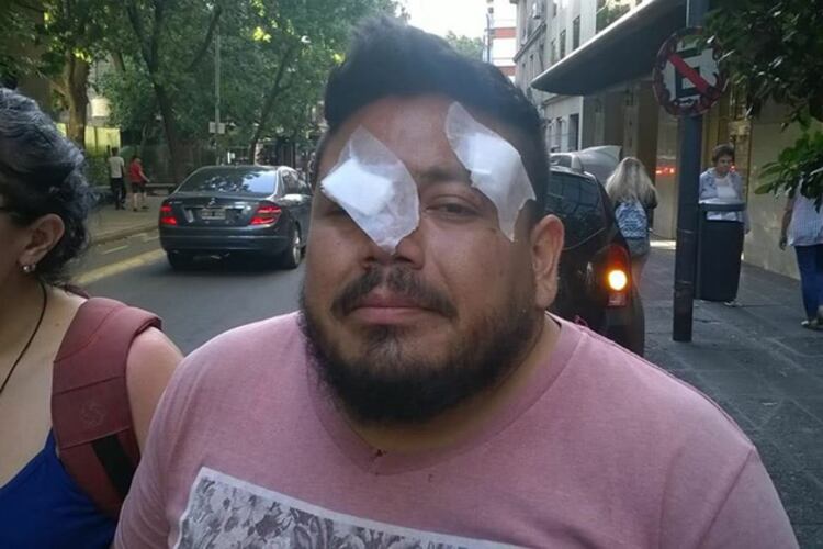Daniel Sandoval, una de las víctimas de la represión policial el lunes pasado.