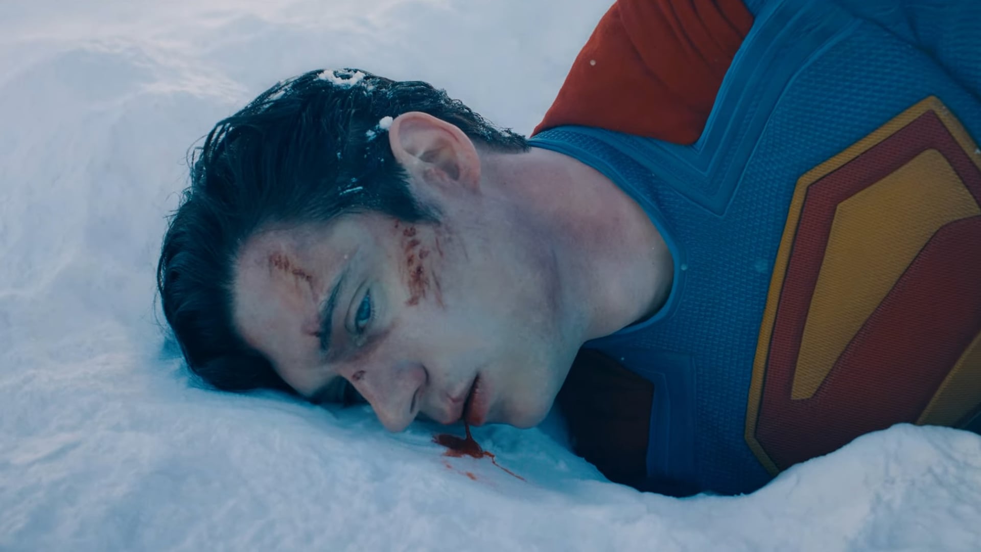 La película muestra a un Superman herido.