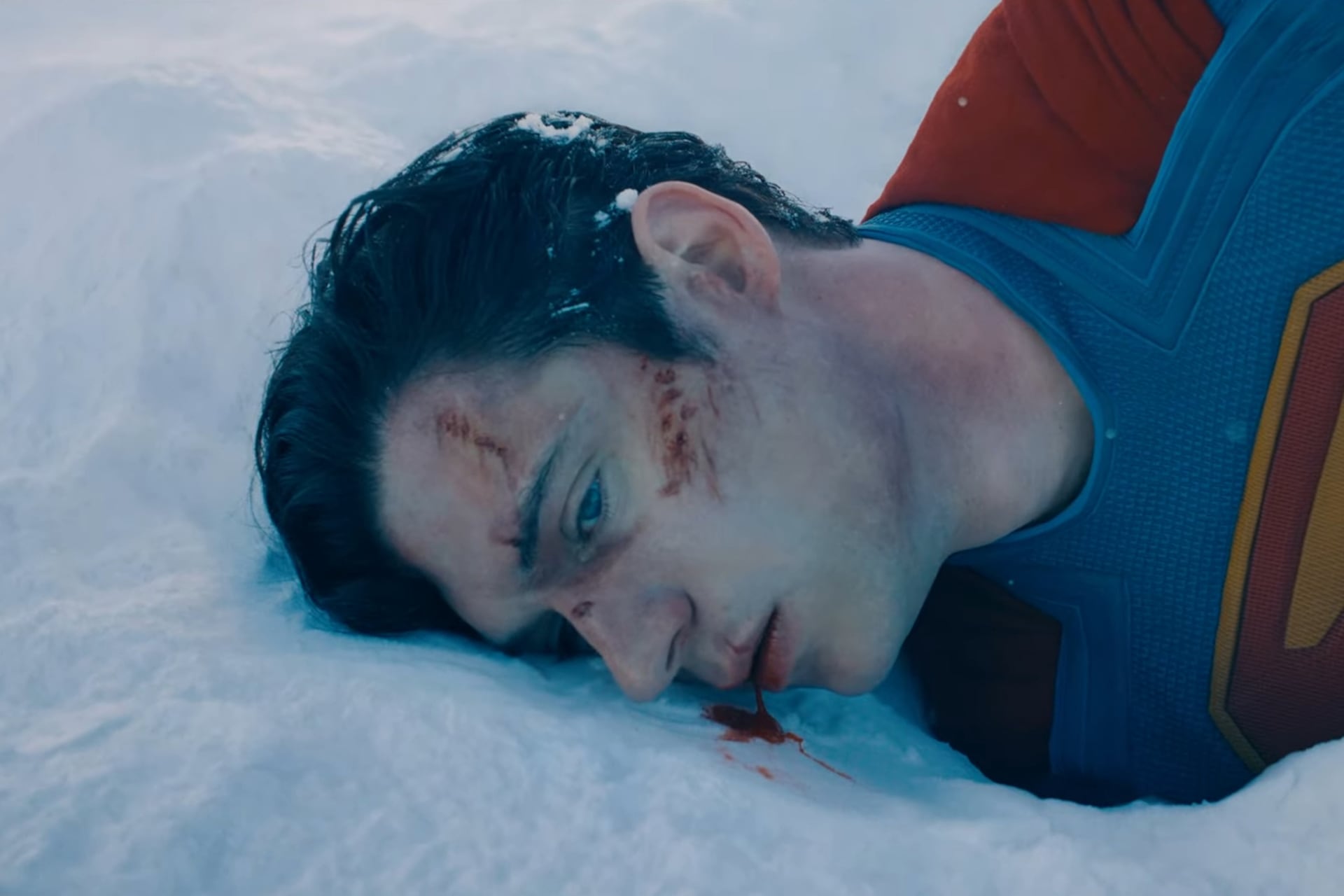 La película muestra a un Superman herido.